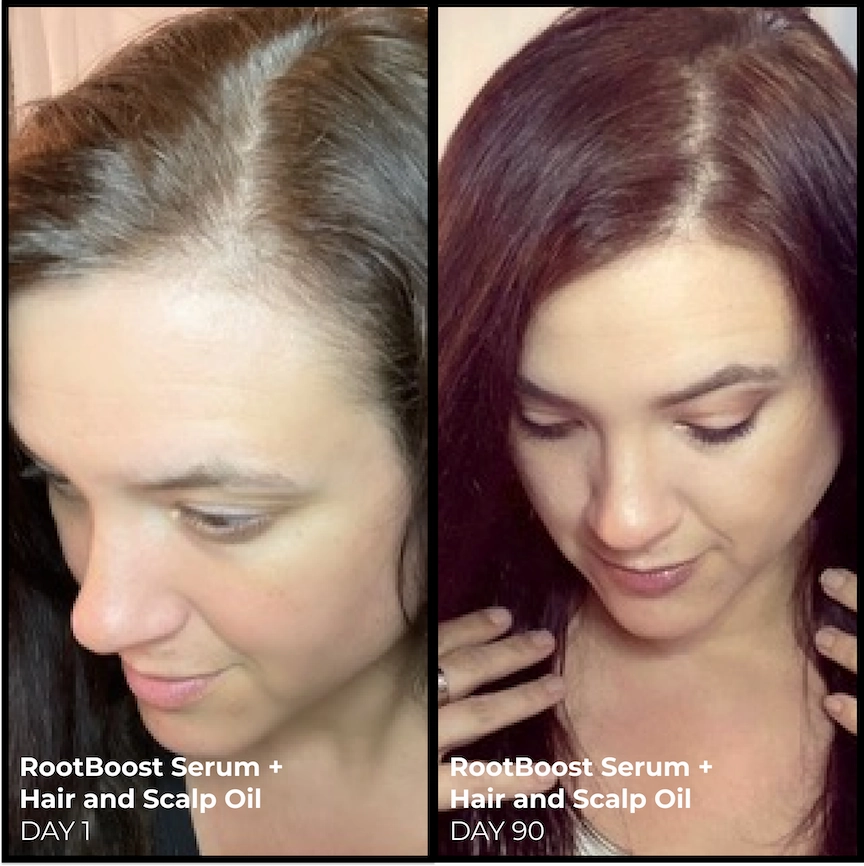 Better Roots Scalp   Hair Oil