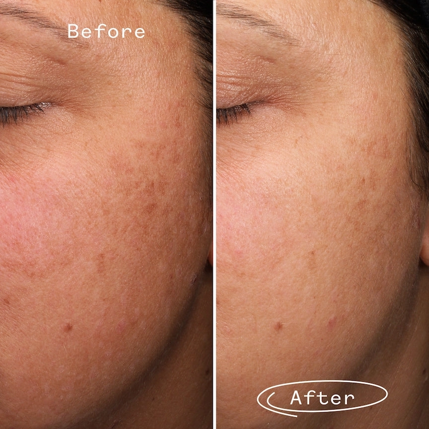 Fade Forward Dark Spot Serum