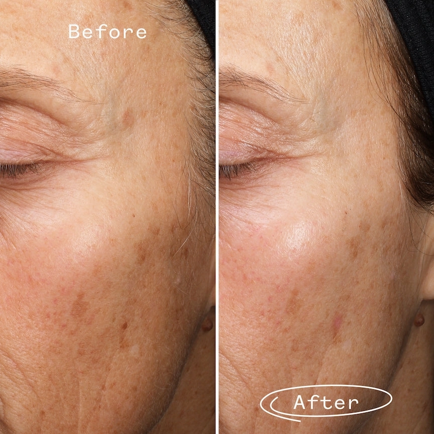 Fade Forward Dark Spot Serum