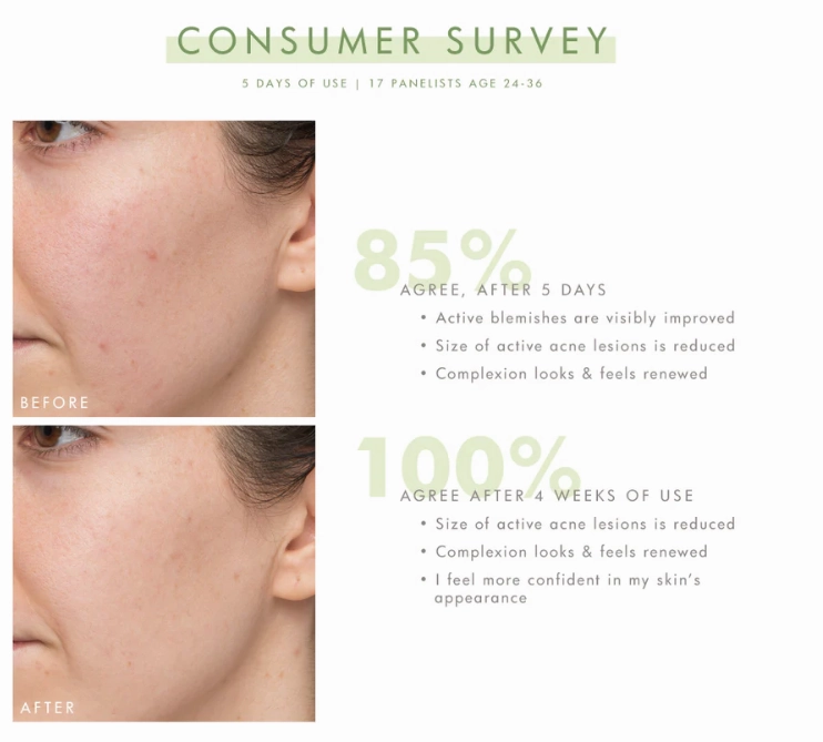 Farmhouse Fresh Comeback Clear Rapid Relief Acne Kit