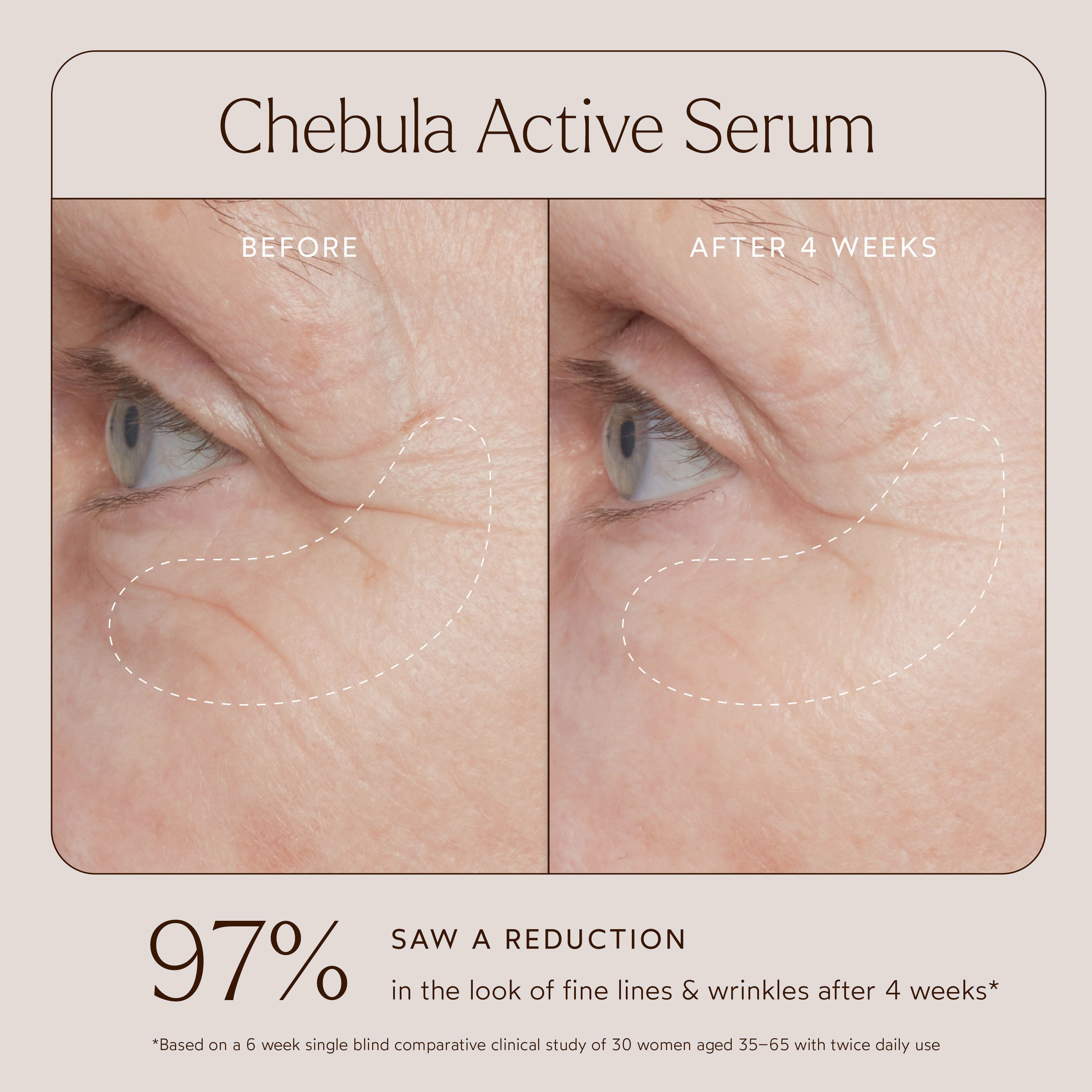 Renew Chebula Active Serum