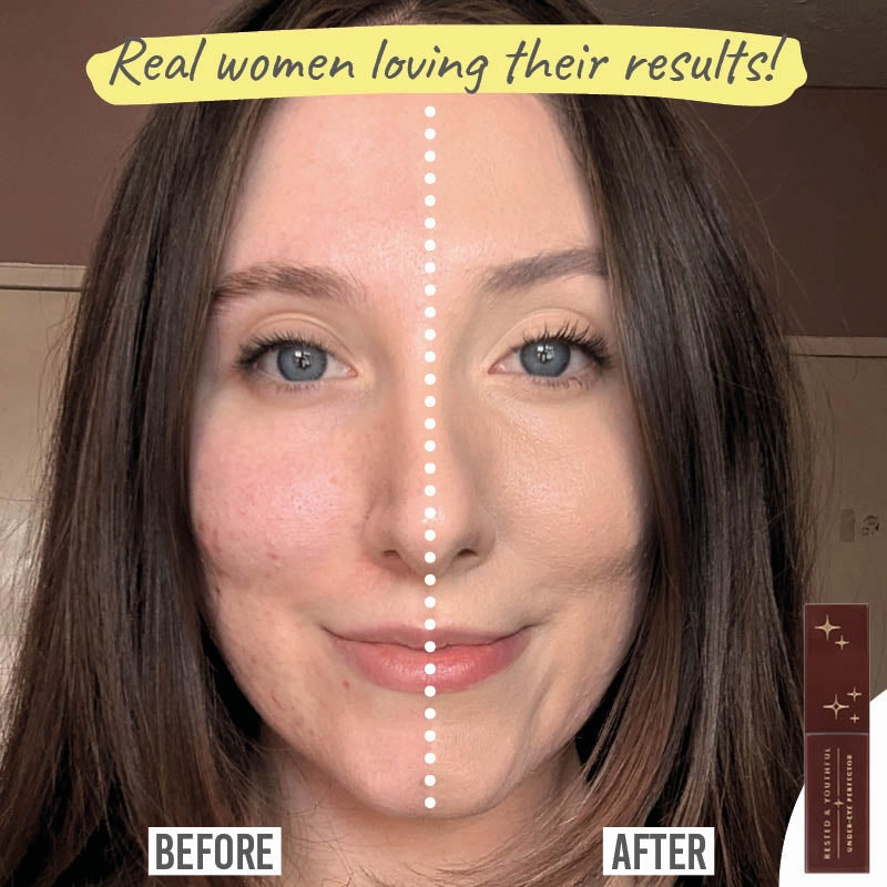 Rested & Youthful Under Eye Perfector