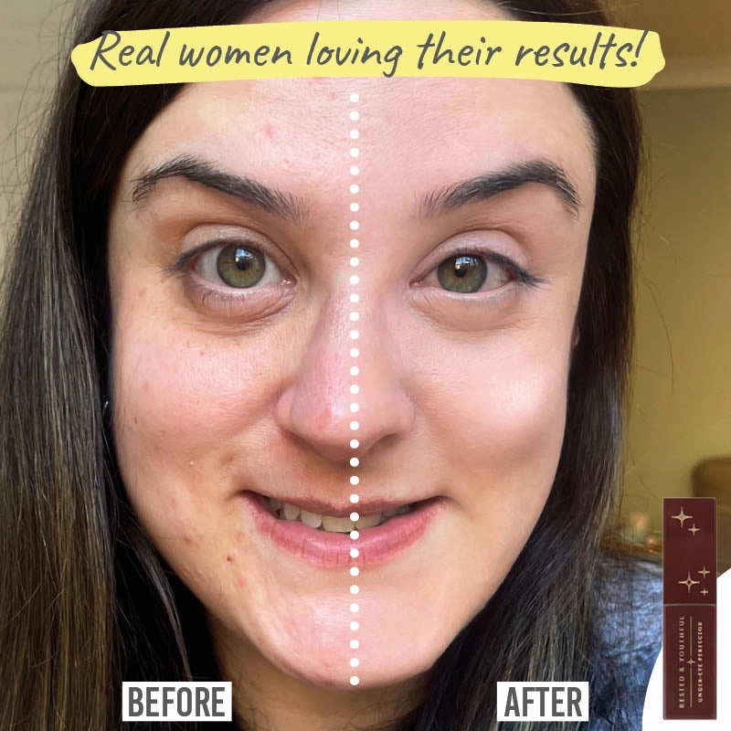 Rested & Youthful Under Eye Perfector