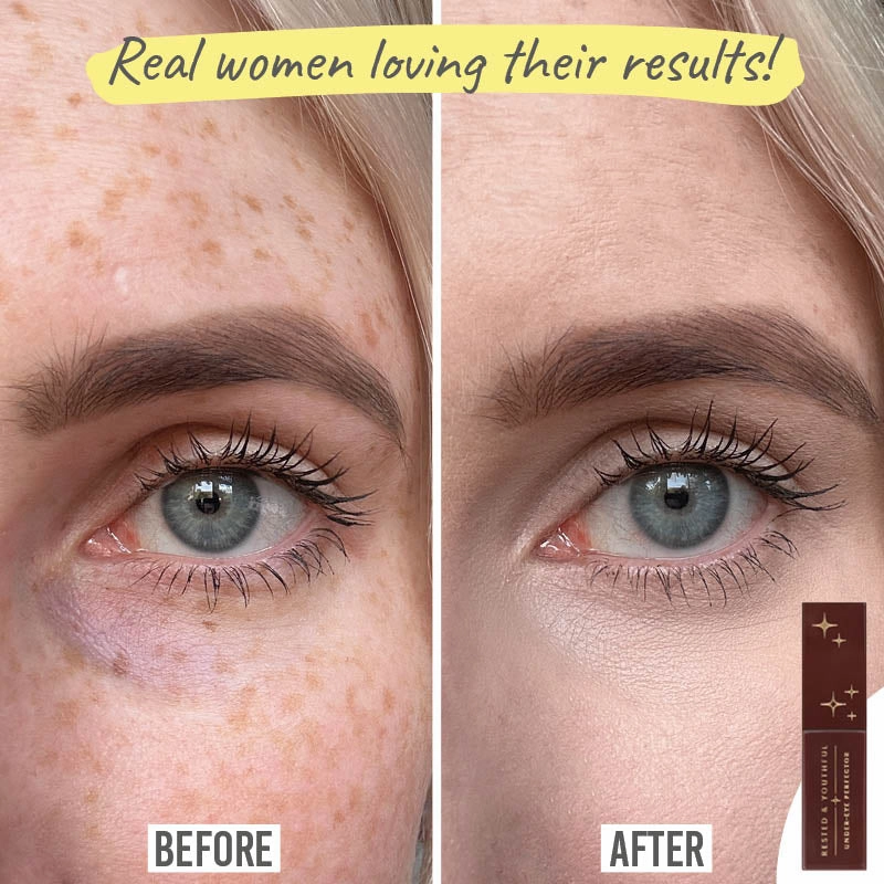 Rested & Youthful Under Eye Perfector