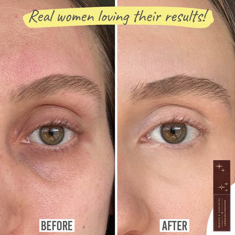 Rested & Youthful Under Eye Perfector