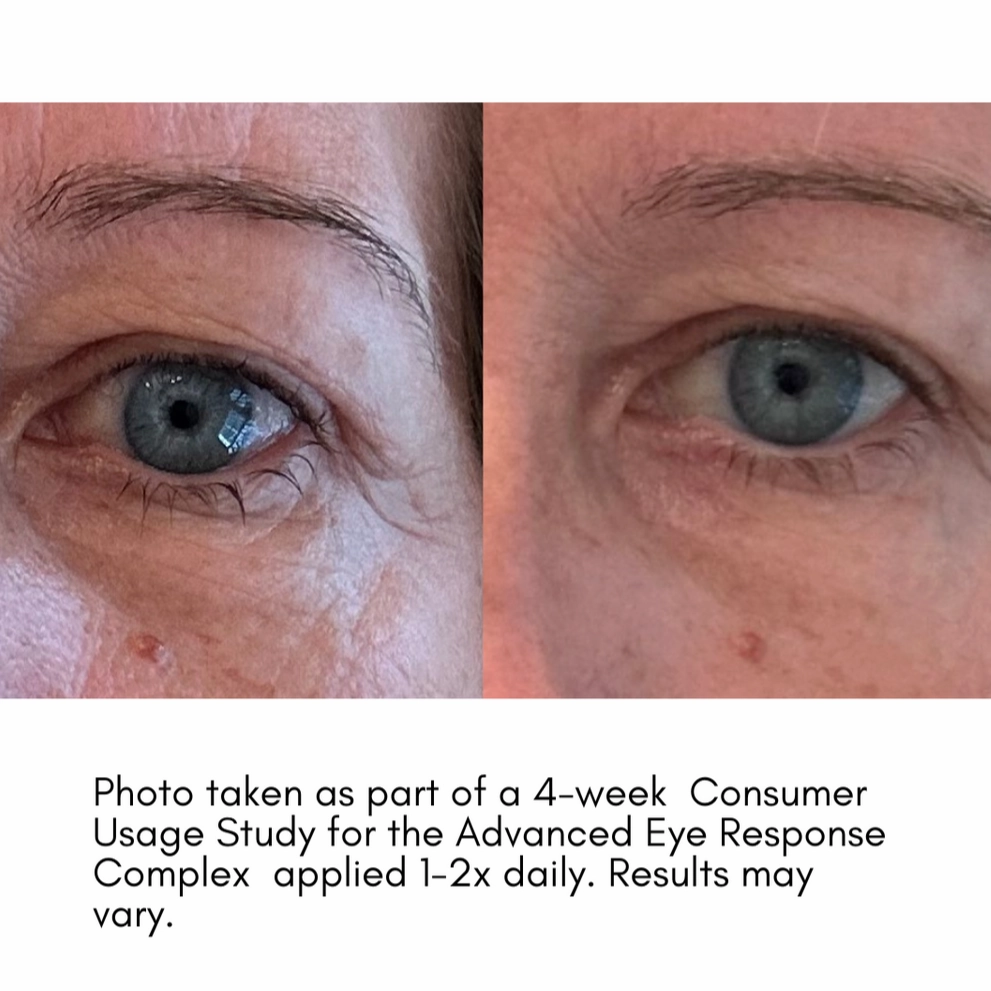 The Advanced Eye Response Complex
