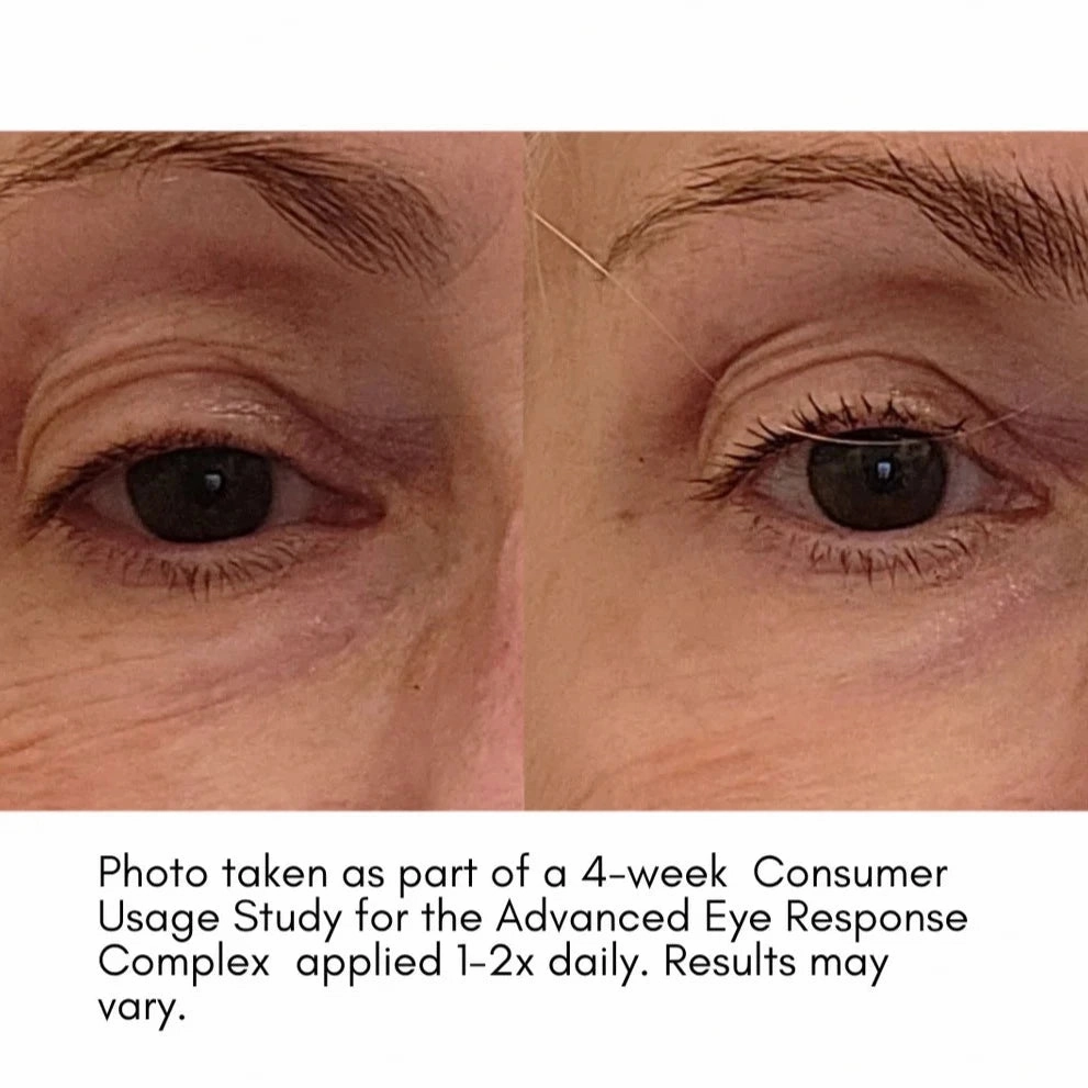 The Advanced Eye Response Complex