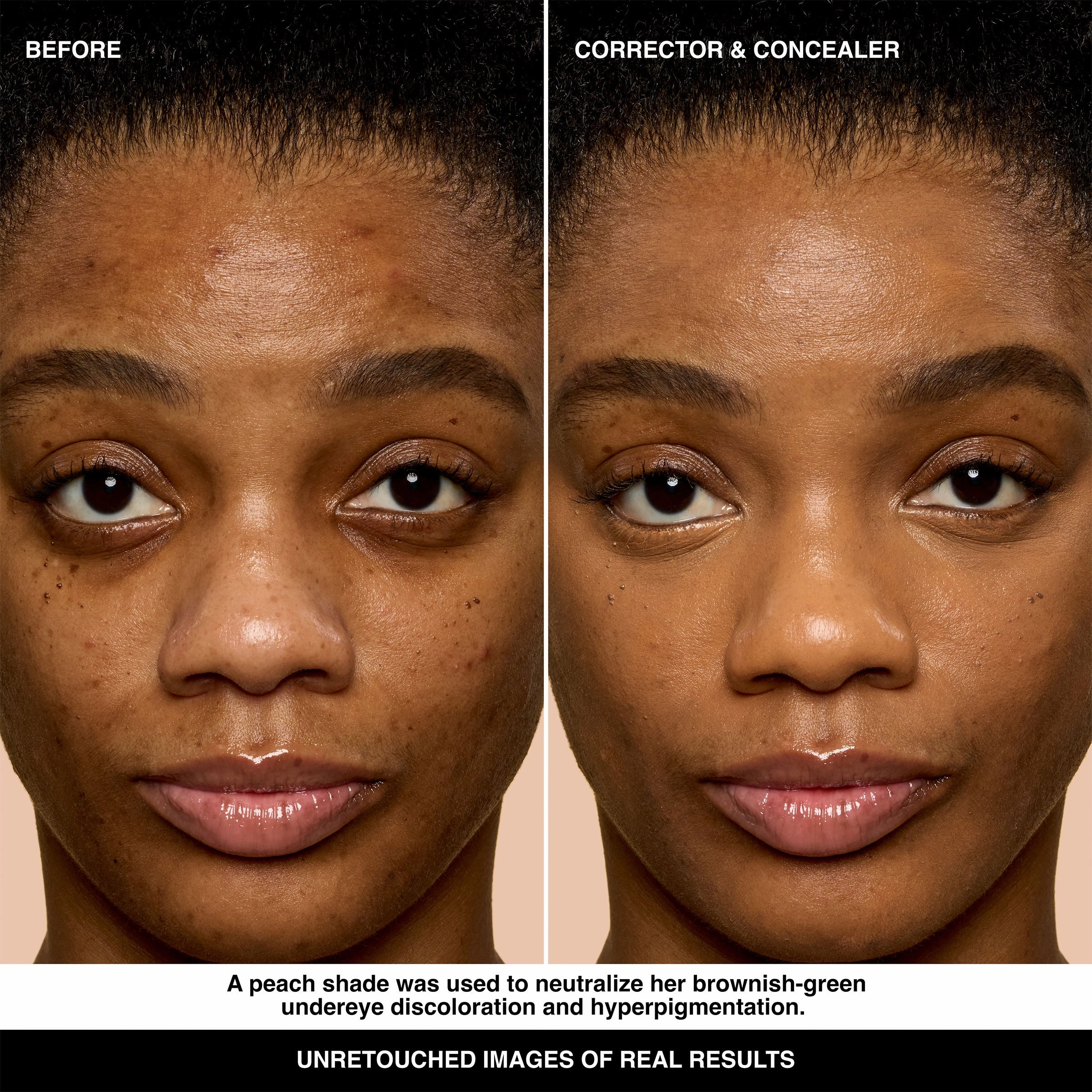 Under Eye Corrector